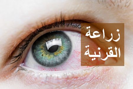 زراعة القرنية