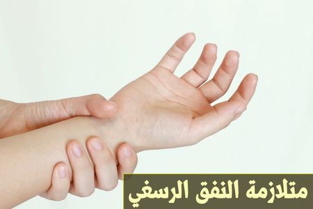 متلازمة النفق الرسغي